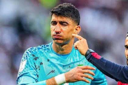 علیرضا بیرانوند جام جهانی را از دست داد