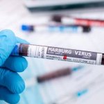 هشدار کشورهای عربی به مسافران درباره ویروس «ماربورگ»