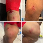 چمن مصنوعی ورزشگاه باعث آسیب پای ملی‌پوشان ایران شد